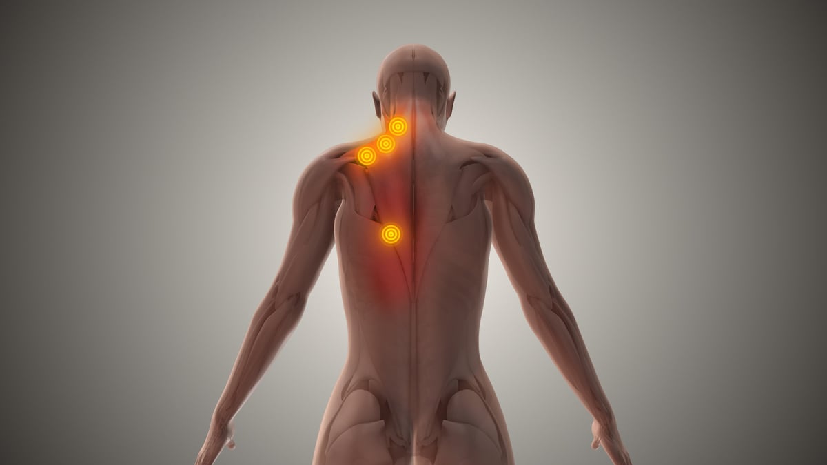 Therapist's hands applying pressure to a sensitive trigger point in a muscle to relieve referred pain